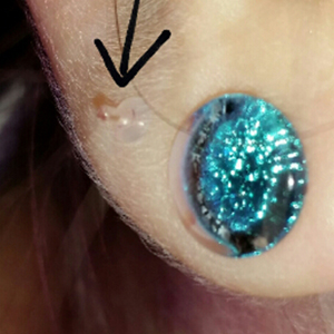 Quartz Glass Plug Customer Photo